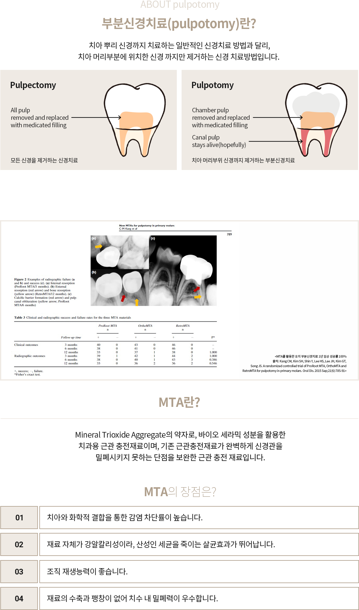 Pulpectomy vs Pulpotomy 비교 도식 및 MTA 장점